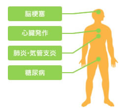 歯周病と全身疾患の関係