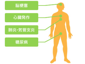 歯周病と全身疾患の関係